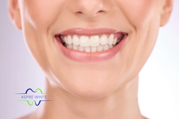 Follow your teeth whitening aftercare Wellingborough to prolong your whiter smile!