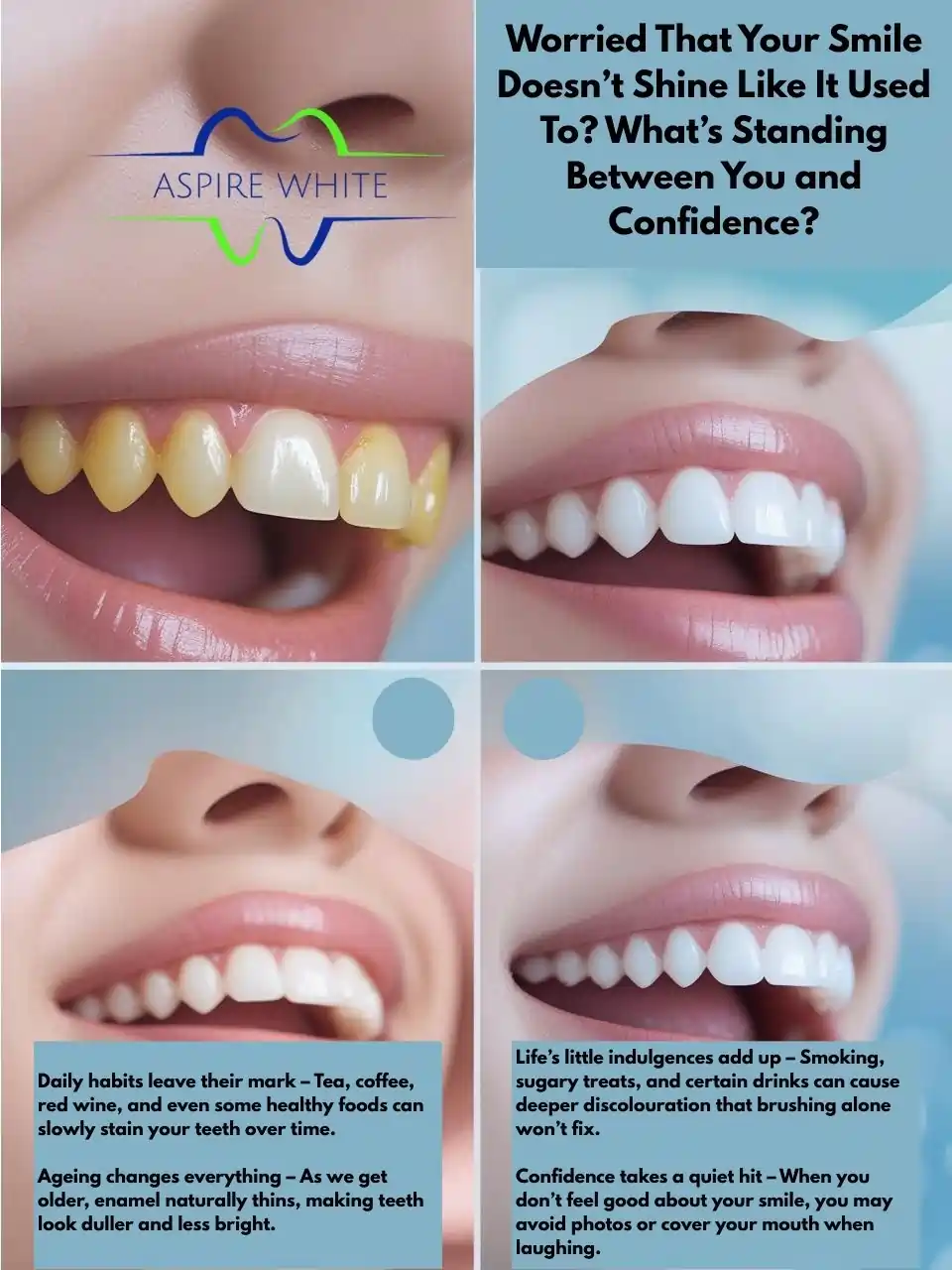 Worried That Your Smile Doesn’t Shine Like It Used To What’s Standing Between You and Confidence Wellingborough